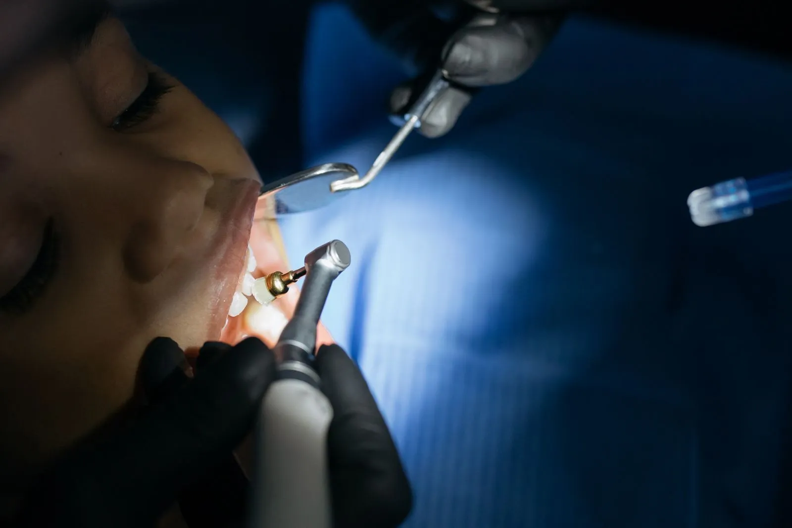 Close-up of a child receiving a dental checkup in a modern clinic with professional tools.